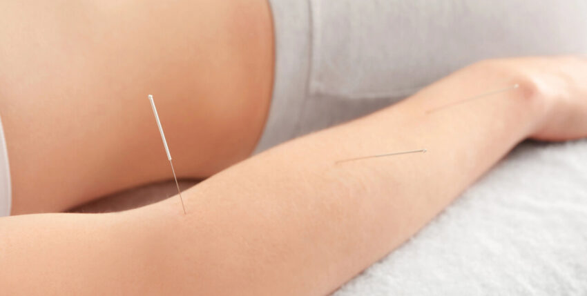 Pain-Free Movement Starts Here: The Benefits of Dry Needling for Tennis Elbow