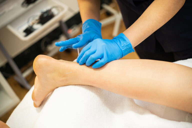 is dry needling safe calgary downtown