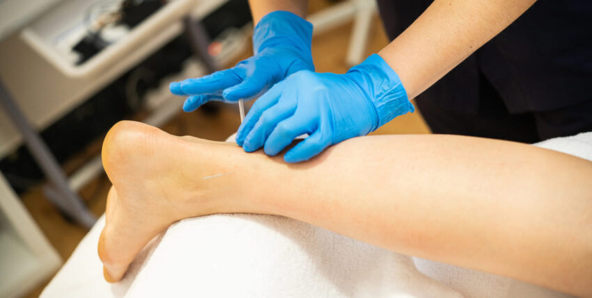 Modern Pain Management Explained: Is Dry Needling a Safe Option?