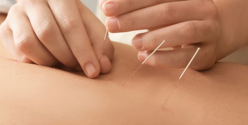 Comparing Acupuncture and Dry Needling: Traditional Meets Modern