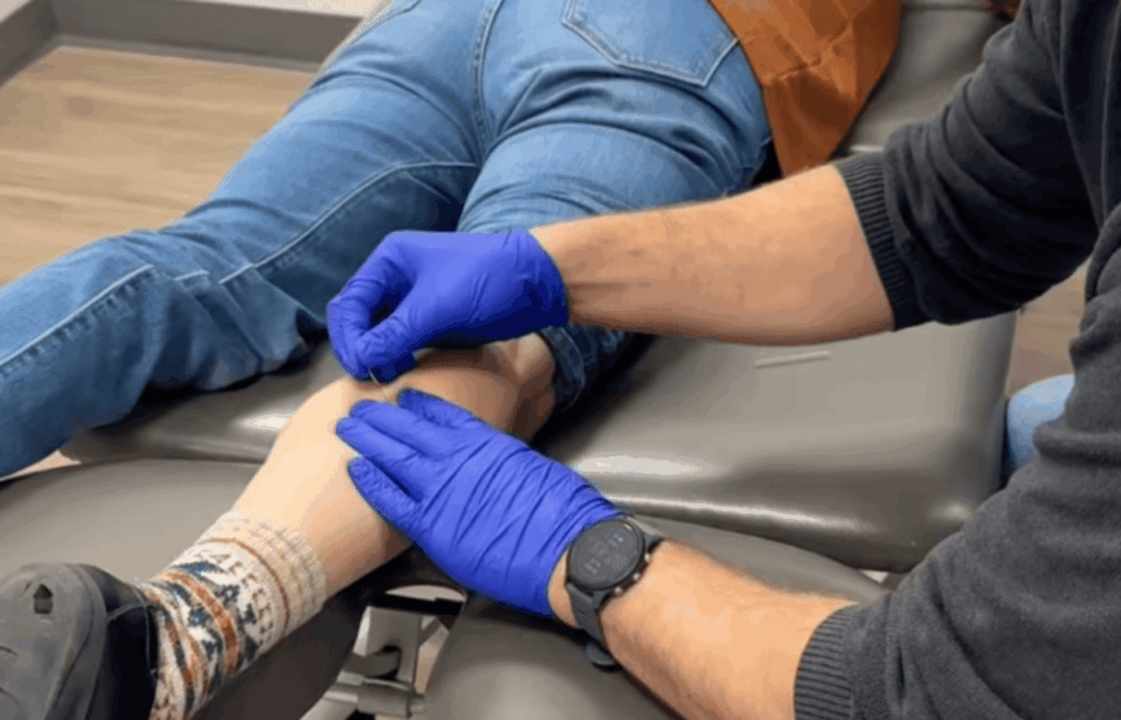 ims dry needling nervous system needle