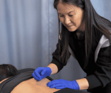 ims treatment nervous system