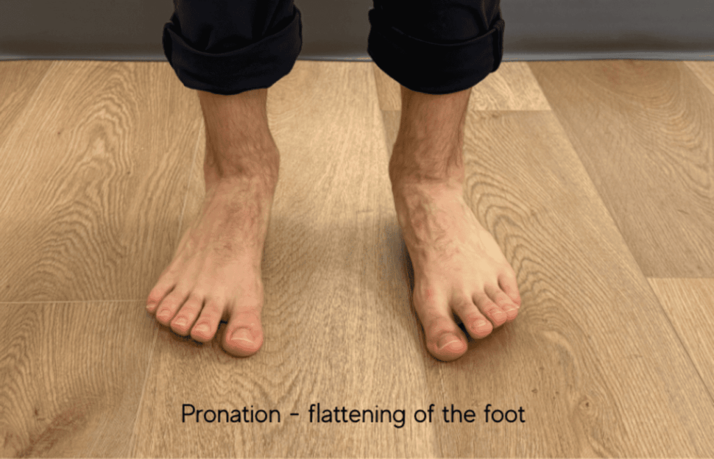 flat feet and high arches foot physio
