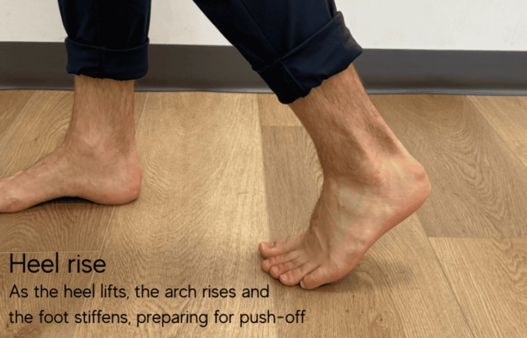 flat feet and high arches foot physiotherapy
