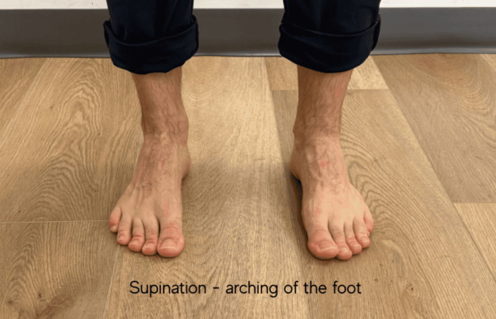 foot physio for flat feet and high arches