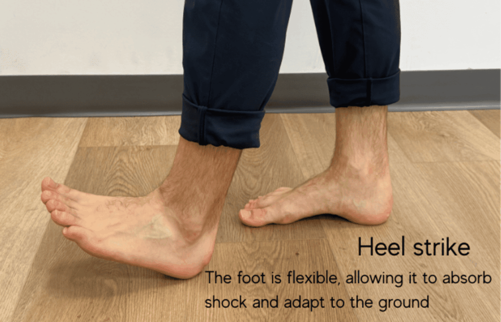 foot physiotherapy flat feet and high arches