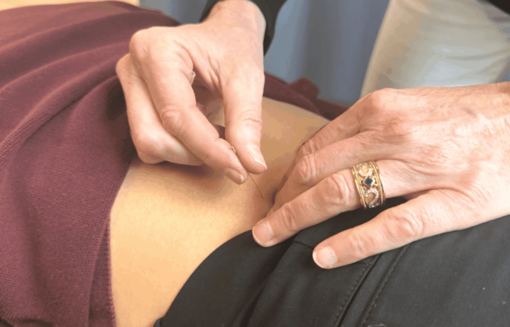 IMS vs acupuncture
