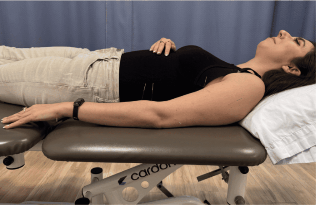 acupuncture vs dry needling