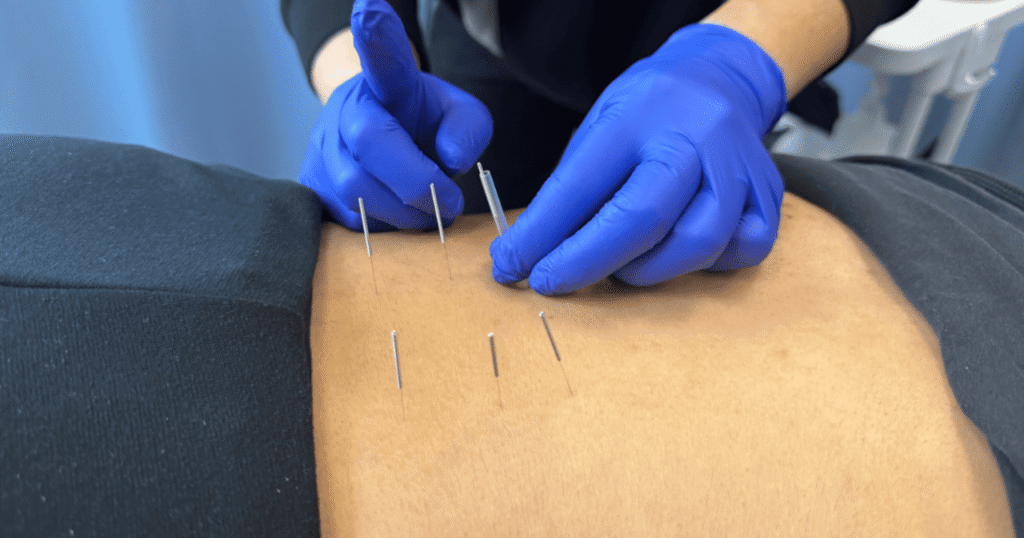 relieve post physiotherapy muscle pain and stiffness